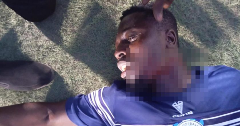 Nijerya Ligi’nde dehşet verici olay! Gol attığı için rakip taraftar sahaya girip boğazını kesti…